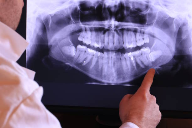 Best Emergency Tooth Extraction in Kaibito, AZ