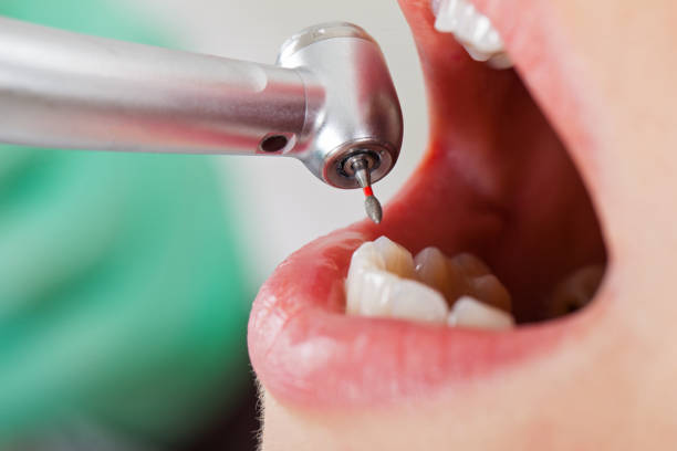 Best Emergency Treatment for Dental Infections or Abscesses in Kaibito, AZ